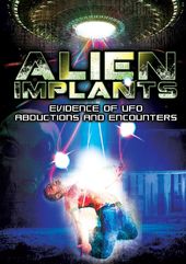 Alien Implants: Evidence Of UFO Abductions And