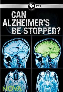 PBS - NOVA: Can Alzheimer's Be Stopped?