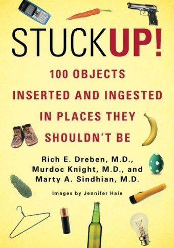 Stuck Up!: 100 Objects Inserted and Ingested in